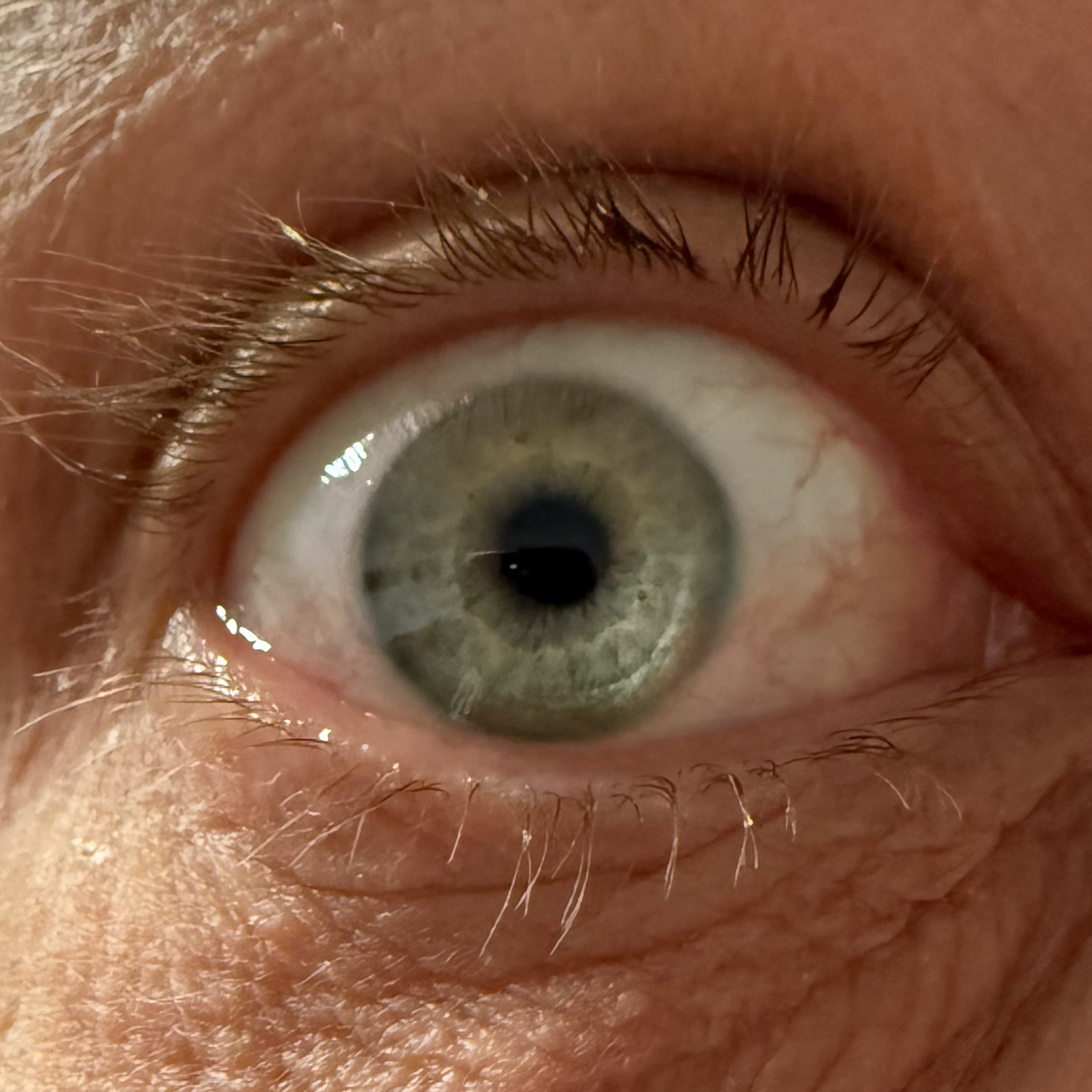 Beispiel für ein scharfes Iris-Foto mit dem Smartphone aufgenommen für MyElara Schmuck